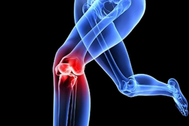 Patellofemoral pain